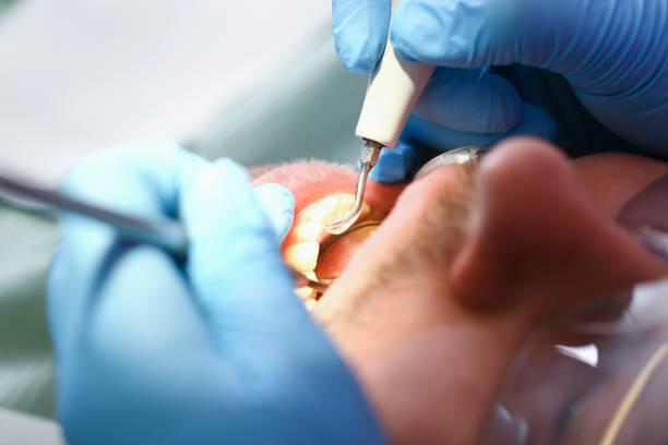 Best Emergency Dentist for Knocked-Out Tooth in East Brady, PA