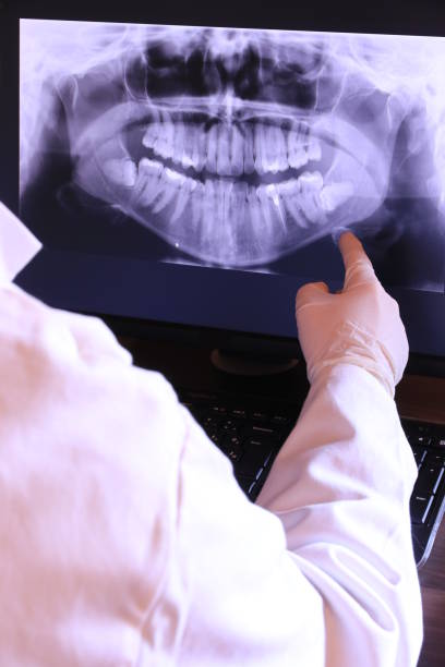 Best Emergency Dental Care for Abscessed Tooth in East Brady, PA